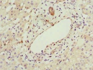 HBXIP Antibody