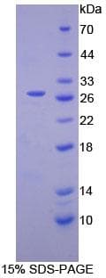 Mouse CR2 / CD21 Protein (Recombinant His, N-Terminal)