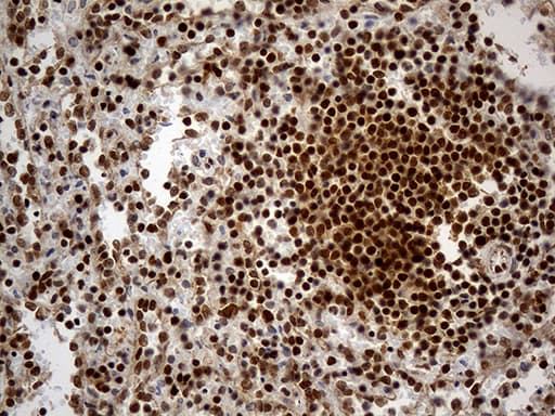 Monoclonal Mouse anti-Human HNRNPH1 / hnRNP H Antibody (clone OTI1H3, Carrier-free, IHC, WB)