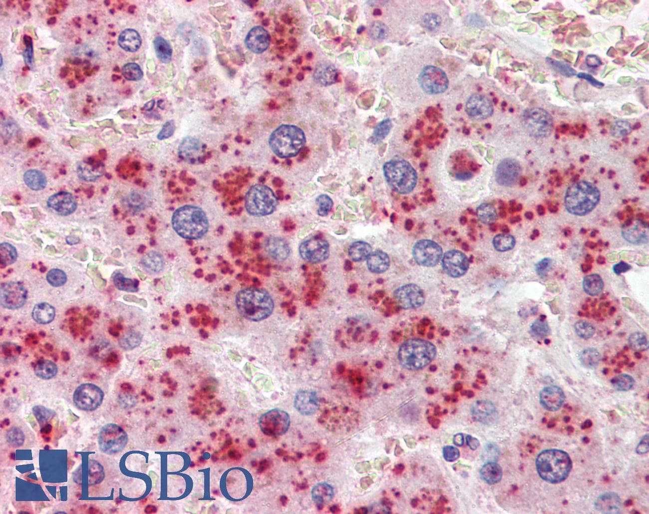 IHC-plus™ ALCAM / CD166 Antibody (clone 10F1G12)
