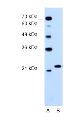RAB14 Antibody (C-Terminus)