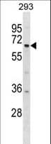 DYRK1B Antibody (aa377-405)