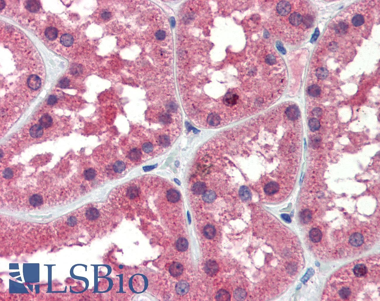 PathPlus™ IDH1 / IDH Antibody (aa290-339)