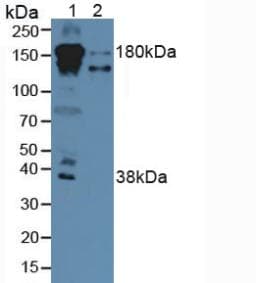 CFH / Complement Factor H Antibody (aa860-1231)