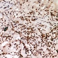 CBX5 / HP1 Alpha Antibody