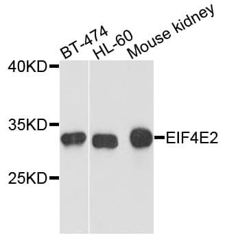EIF4E2 / IF4e Antibody