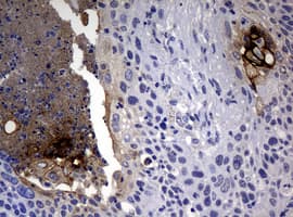 Sialylated Lewis a / CA 19-9 Antibody (clone NS19)