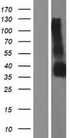 GPM6B Protein (Over-Expression Lysate Myc-DDK (Flag))