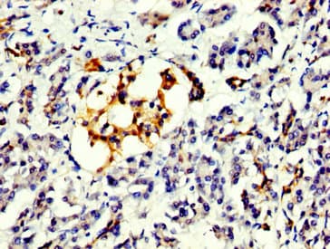 PRDM10 / TRIS Antibody