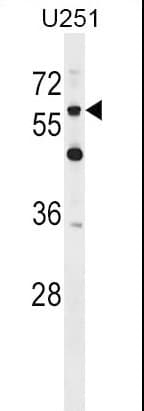 CSPG5 / Neuroglycan C Antibody (aa530-559)