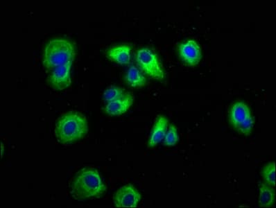 Polyclonal Rabbit anti-Human AXIN2 / Axin 2 Antibody (IHC)