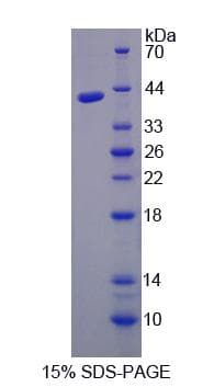 Human ALAD Protein (Recombinant His-S)