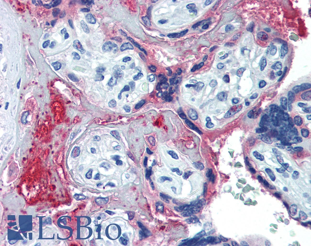 IHC-plus™ Complement C6 Antibody (C-Terminus, clone 056B-214.2.4.2)