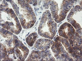 ARMC1 Antibody (clone OTI2G8, Carrier-free)
