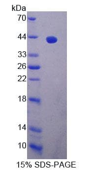 Rat EXOC3 / SEC6 Protein (Recombinant His-T7, N-terminus)