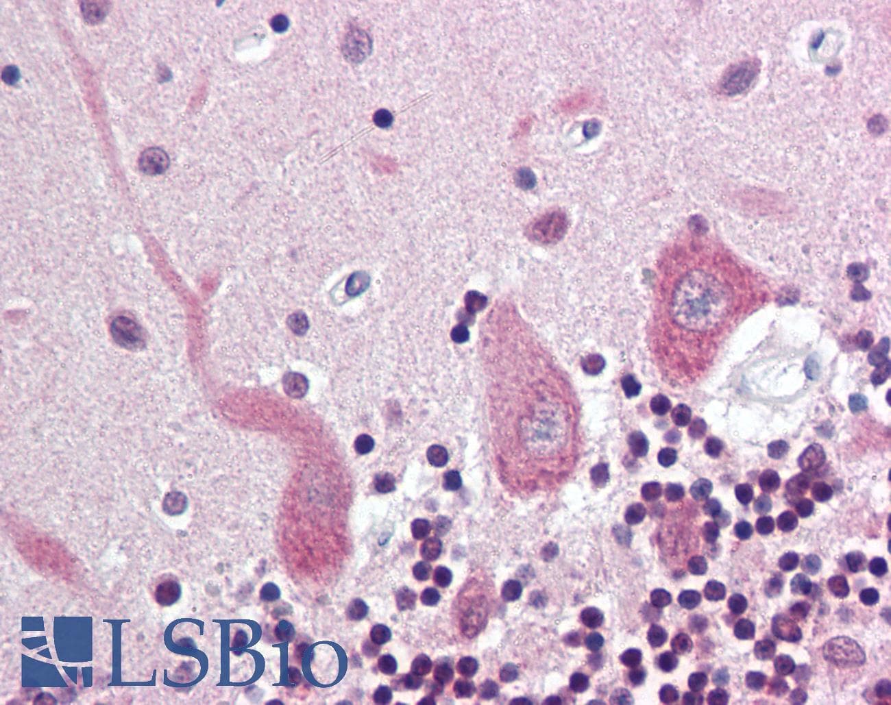 IHC-plus™ Synuclein Alpha + Beta Antibody