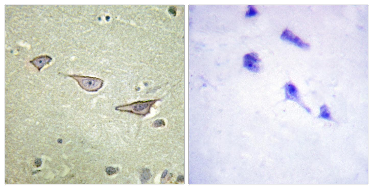 Polyclonal Rabbit anti-Human COX15 Antibody (IHC)