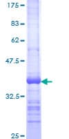 Human TIRC7 / TCIRG1 Protein (Recombinant GST, N-terminus)
