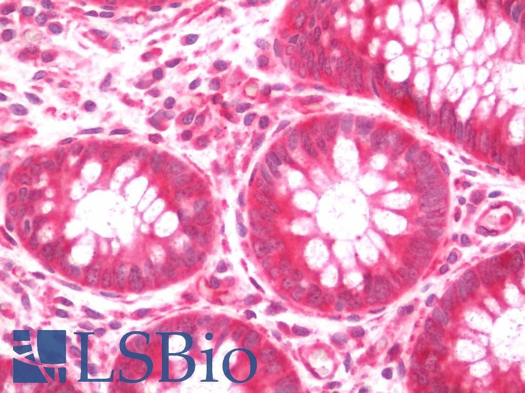 TGFB3 / TGF Beta3 Antibody (FITC)