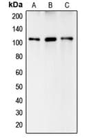 Complement C6 Antibody (Internal)