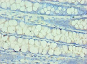 GLNRS / QARS Antibody (aa1-250)