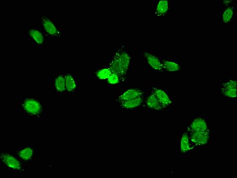 Polyclonal Rabbit anti-Human EAT2 / SH2D1B Antibody (IHC, IF)