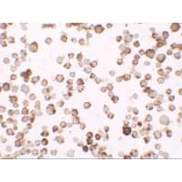 IHC-plus™ Polyclonal Rabbit anti-Human RNASET2 Antibody (IHC, IF, WB)
