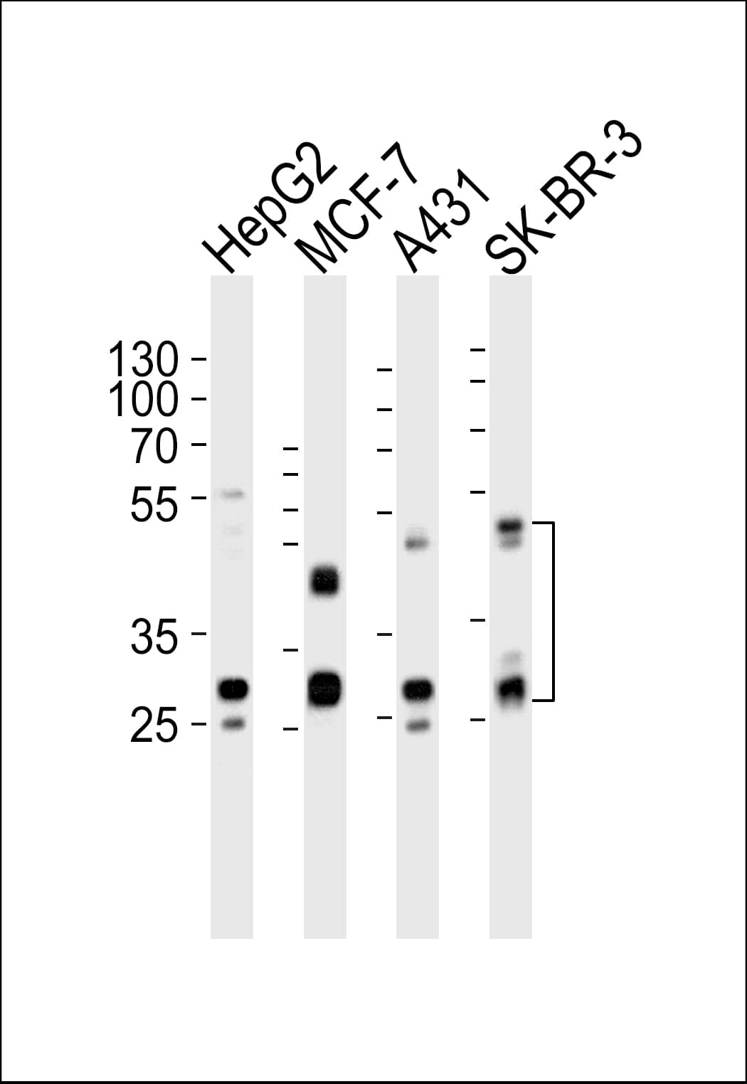 CTSD / Cathepsin D Antibody