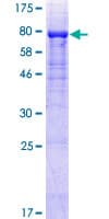 Human PLXDC2 Protein (Recombinant GST)