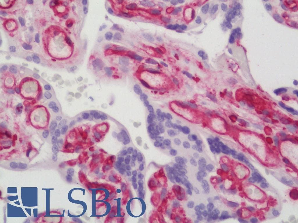 IHC-plus™ Polyclonal Rabbit anti-Human EGFR Antibody (aa651-700, IHC, WB)