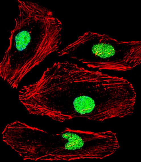 MBD2 Antibody (aa250-279)