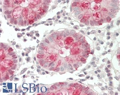IHC-plus™ Polyclonal Rabbit anti-Human MZF / MZF1 Antibody (aa1-46, IHC, WB)