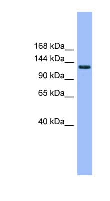 MECOM / EVI1 Antibody (aa359-408)