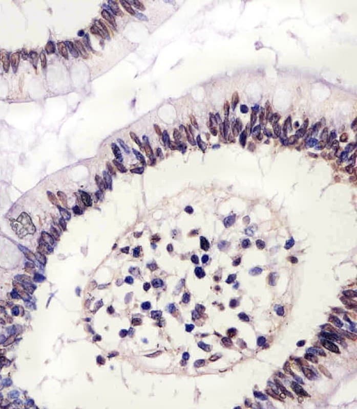 Polyclonal Rabbit anti-Human CTCF Antibody (aa334-364, IHC, WB)