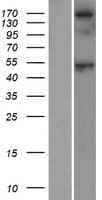 SRL / Sarcalumenin Protein (Over-Expression Lysate Myc-DDK (Flag))