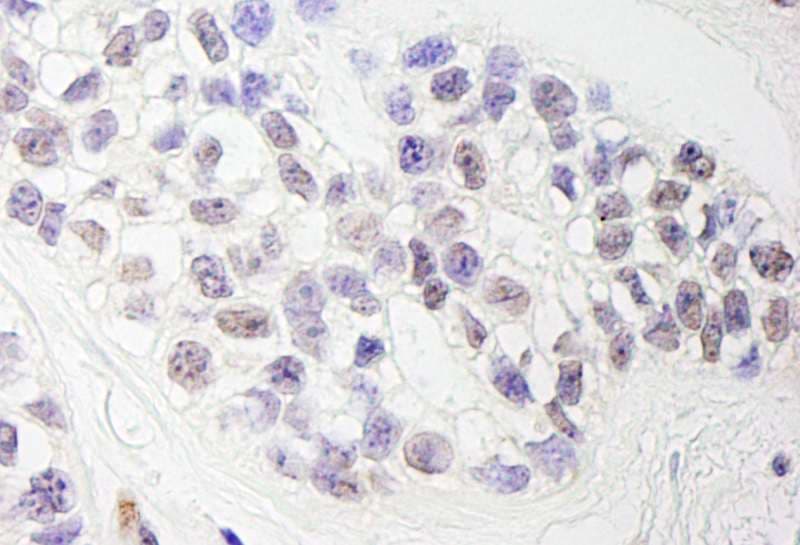 ZEB1 / AREB6 Antibody (aa1074-1124)