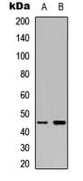 MAP2K1 / MKK1 / MEK1 Antibody (Internal)