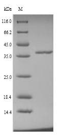 Mosquito D7 Protein (Recombinant 6His, N-terminus)