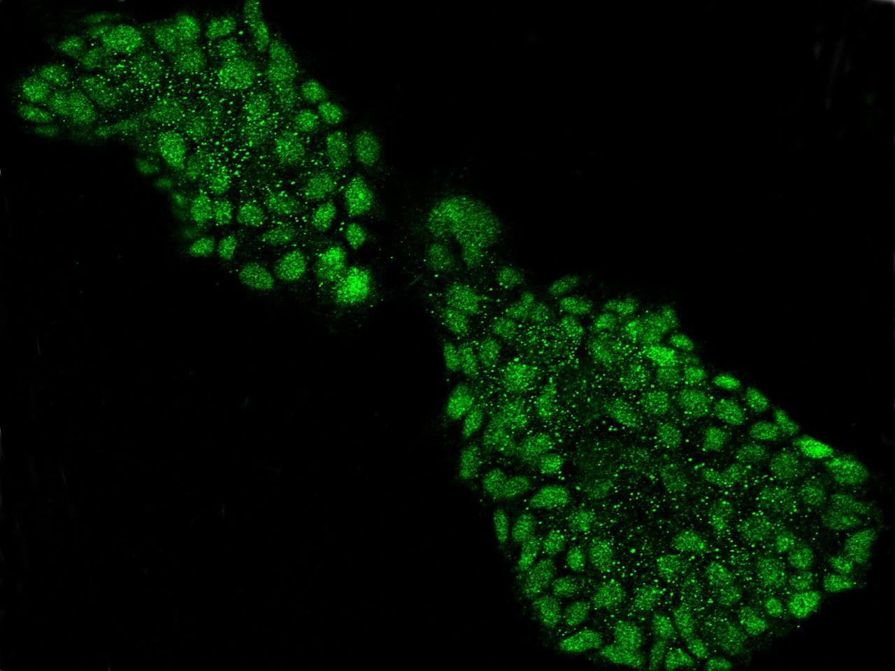 Polyclonal Rabbit anti-Human NEUROG2 / NGN2 / Neurogenin 2 Antibody (Preservative Free, IF, WB)