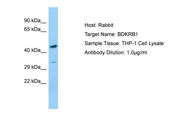 Polyclonal Rabbit anti-Human B1R / BDKRB1 Antibody (aa230-279, WB)