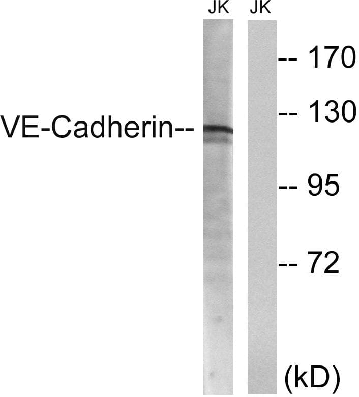 CD144 / CDH5 / VE Cadherin Antibody (p731)