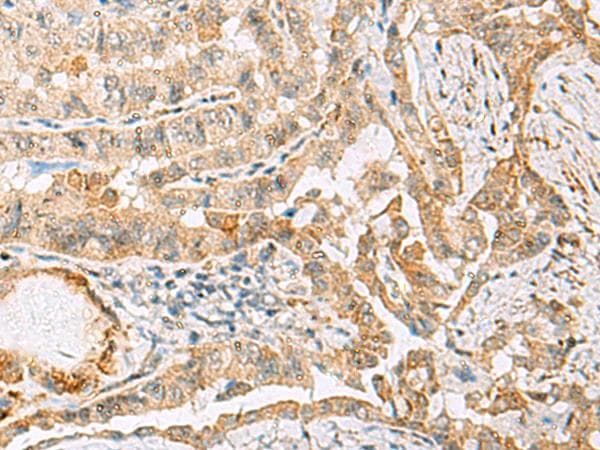 HBZ Antibody