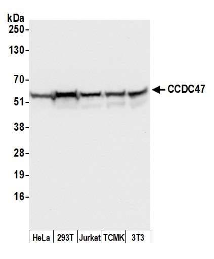 CCDC47 Antibody (aa1-50)