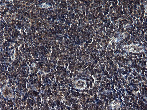 TBX1 Antibody (clone OTI1C2)