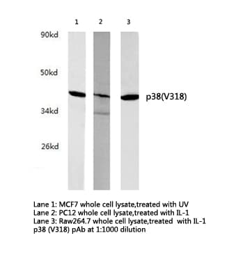 Polyclonal Rabbit anti-Human MAPK14 / p38 Antibody (Val318, WB)