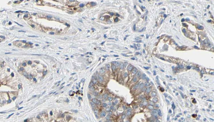 PTP4A2 / PRL-2 Antibody