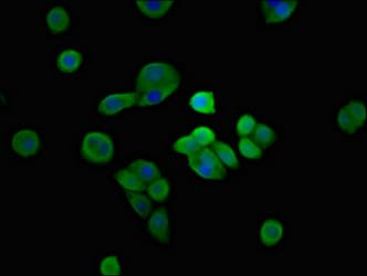 Polyclonal Rabbit anti-Human SH3TC2 Antibody (IHC, IF)