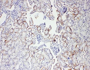SH2D1A / SAP Antibody (aa21-224)