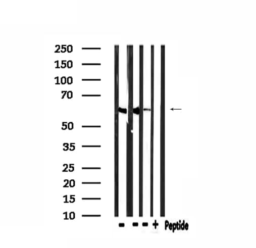 Polyclonal Rabbit anti-Human CDKAL1 Antibody (IF, WB)
