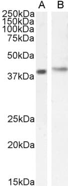 IHC-plus™ CYTIP Antibody (aa2-14)